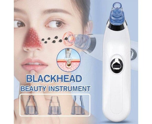 Blackhead Suction Remover & Pore Vacuum | Ultimate Beauty Tool for Deep Pore Cleaning |  Cell Operated