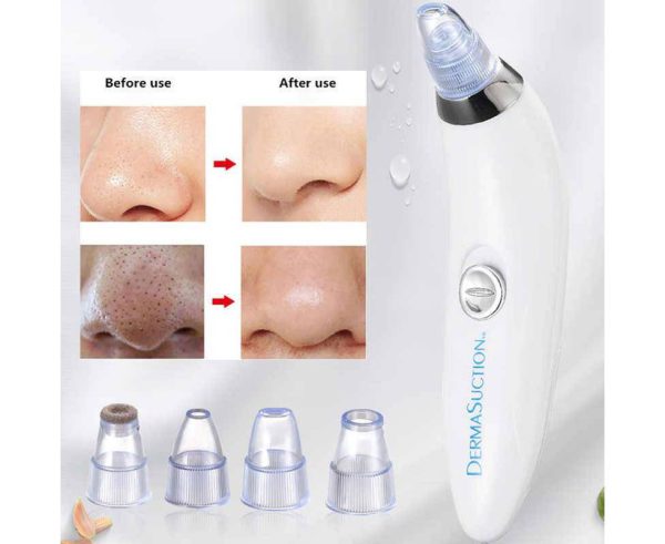 Blackhead Suction Remover & Pore Vacuum | Ultimate Beauty Tool for Deep Pore Cleaning |  Cell Operated