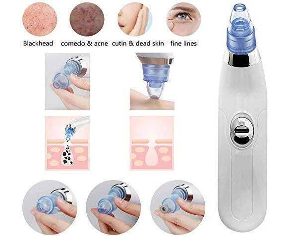 Blackhead Suction Remover & Pore Vacuum | Ultimate Beauty Tool for Deep Pore Cleaning |  Cell Operated